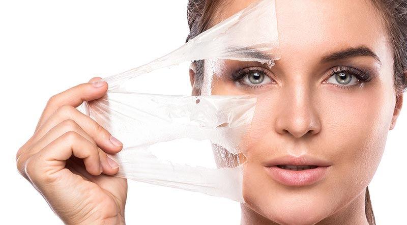 Peeling Químico
