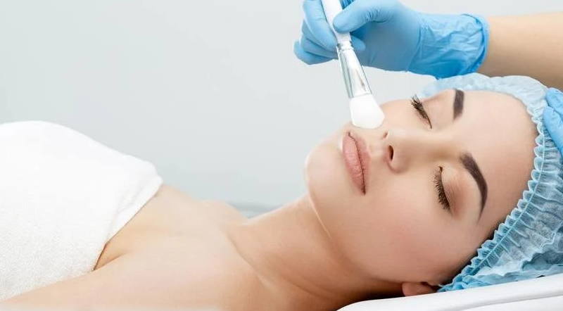 Peeling Químico Leve ou Superficial